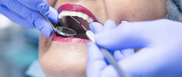 Best Emergency Gum Treatment in Davenport, WA